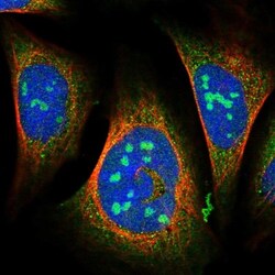 WDCP Antibody, Novus Biologicals:Antibodies:Primary Antibodies